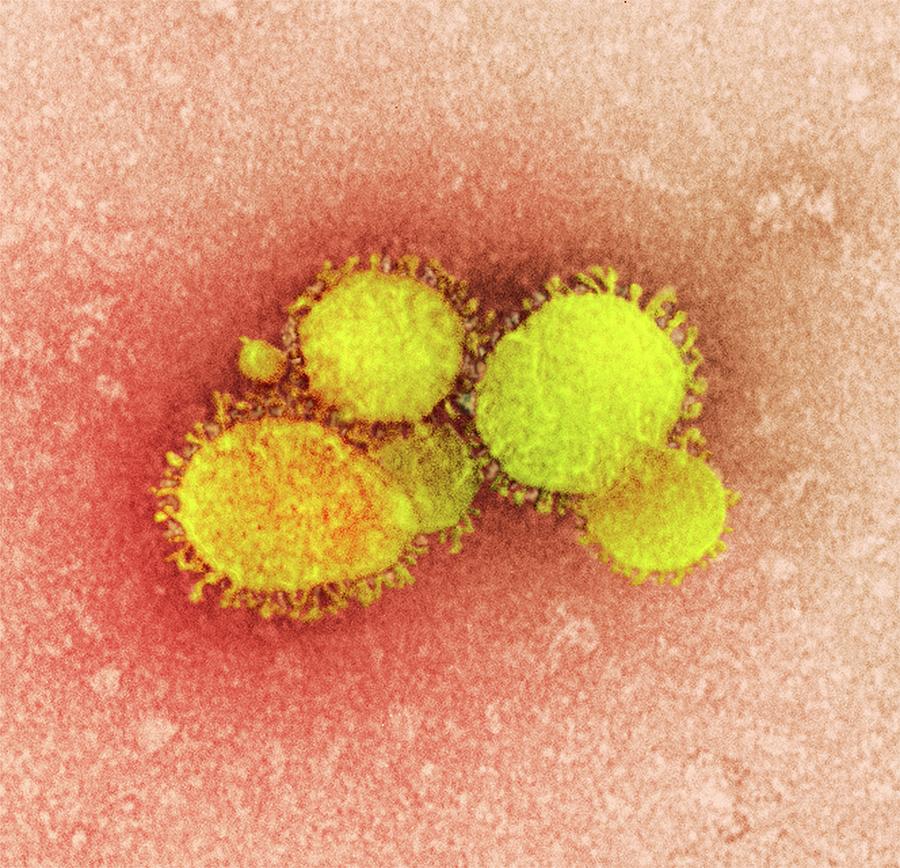 Mers Coronavirus Photograph By Ami Images - Fine Art America