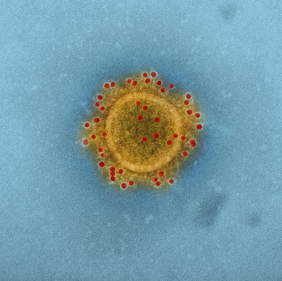 Mers Coronavirus Particles, Tem #3 Photograph by Science Source