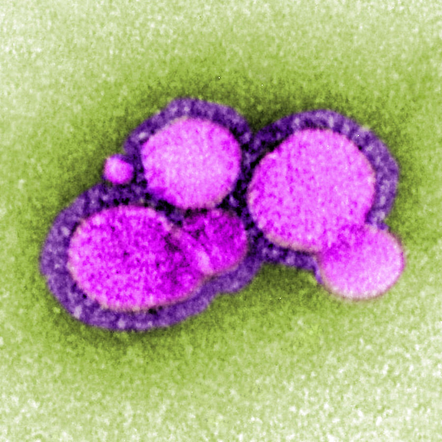 Mers-cov Middle East Respiratory #3 Photograph by Science Source