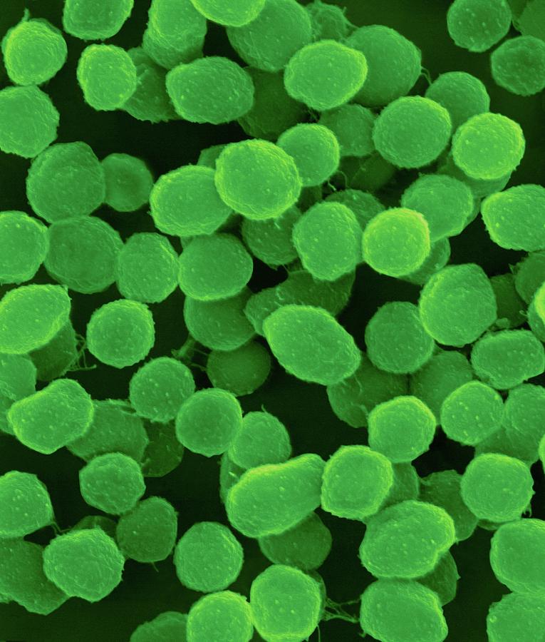 Methanococcus Jannaschii Archaea #3 Photograph by Dennis Kunkel Microscopy/science Photo Library