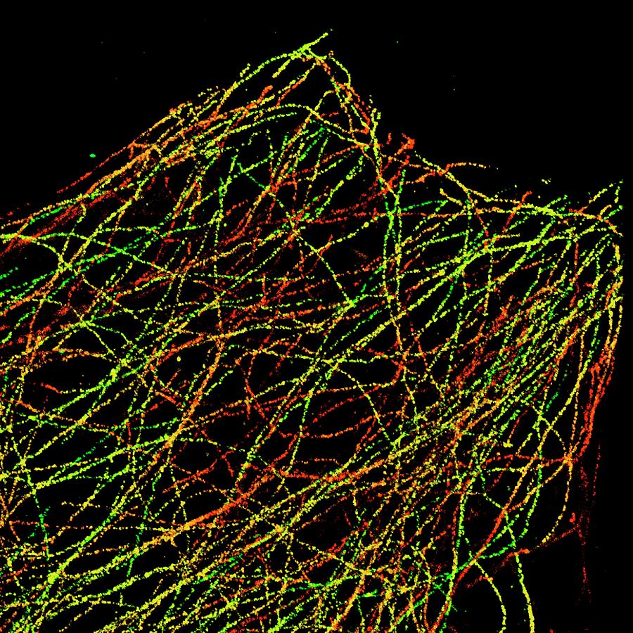 Microtubules #3 Photograph by Ammrf, University Of Sydney