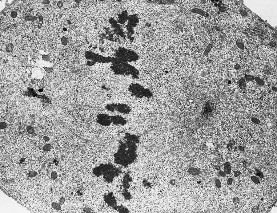 Mitosis, Metaphase, Tem #3 Photograph by David M. Phillips