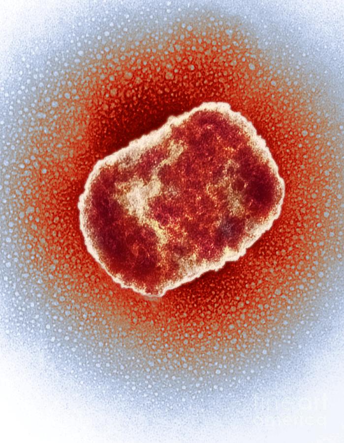 Monkeypox Virus Photograph - Monkeypox Virus Particle, Tem by Centre For Infections/public Health England