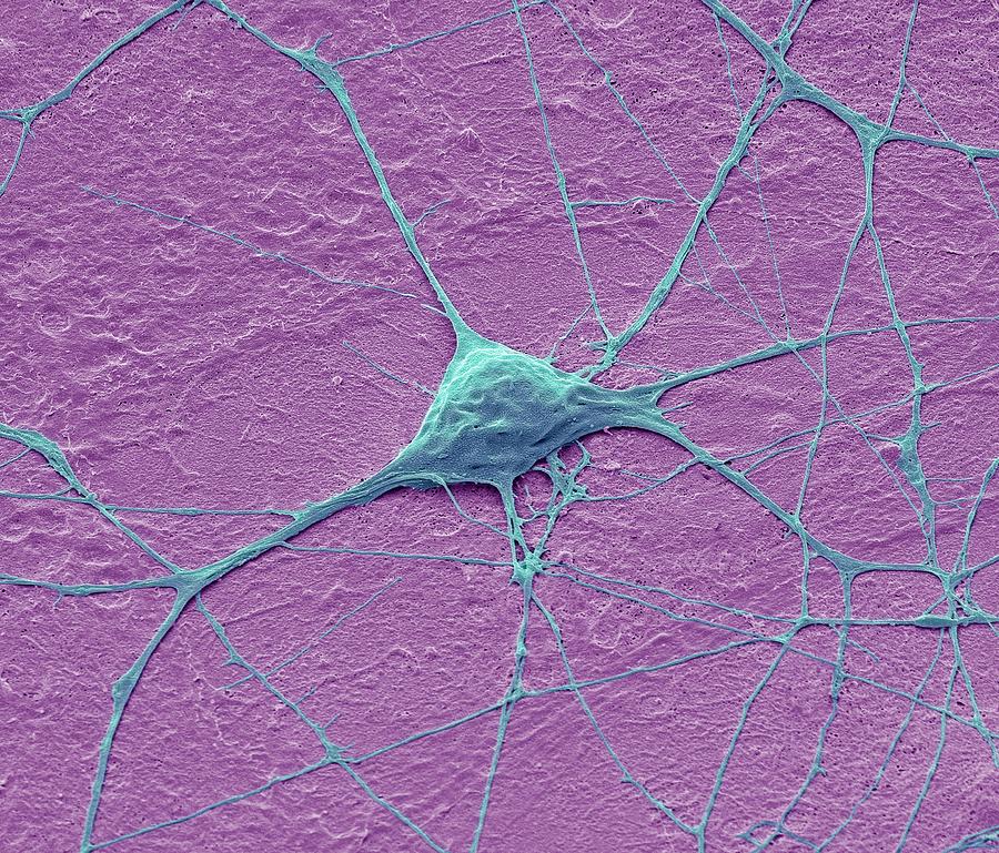 Motor Neurone #3 Photograph by Steve Gschmeissner