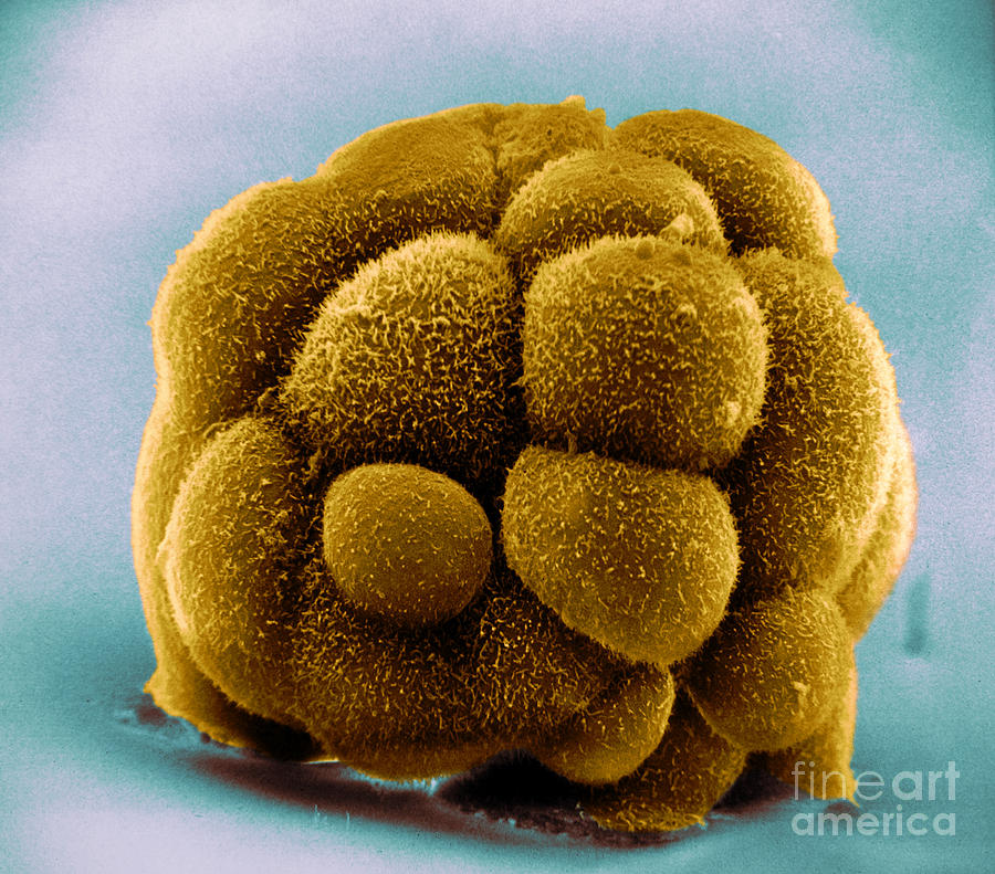 Scanning Electron Micrograph Photograph - Mouse Embryo #3 by David M. Phillips
