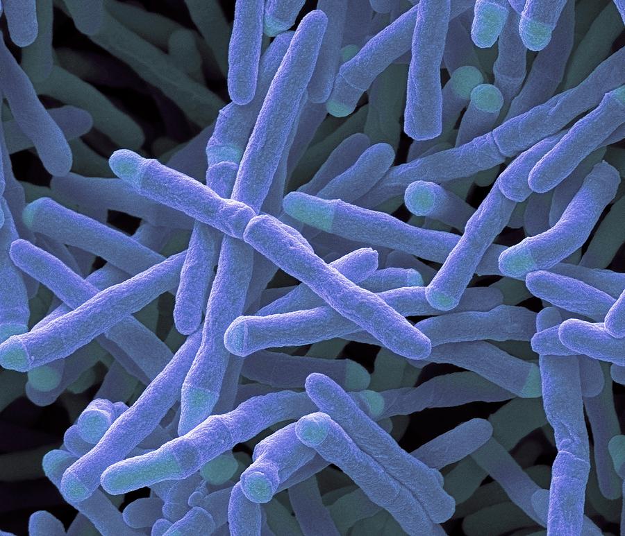 Mycobacterium Smegmatis Bacteria #3 Photograph by Steve Gschmeissner