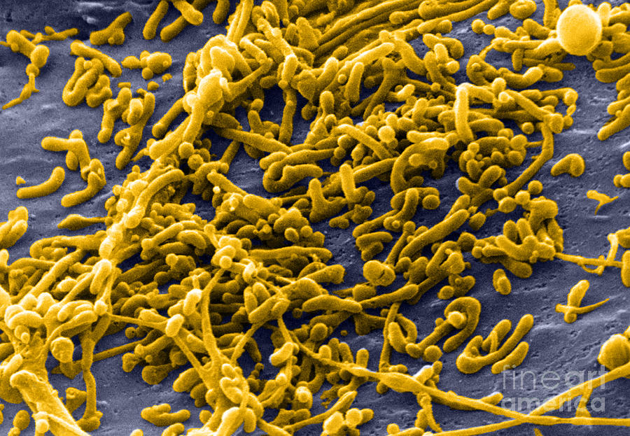 Bacterial Photograph - Mycoplasma Bacteria, Sem #3 by David M. Phillips