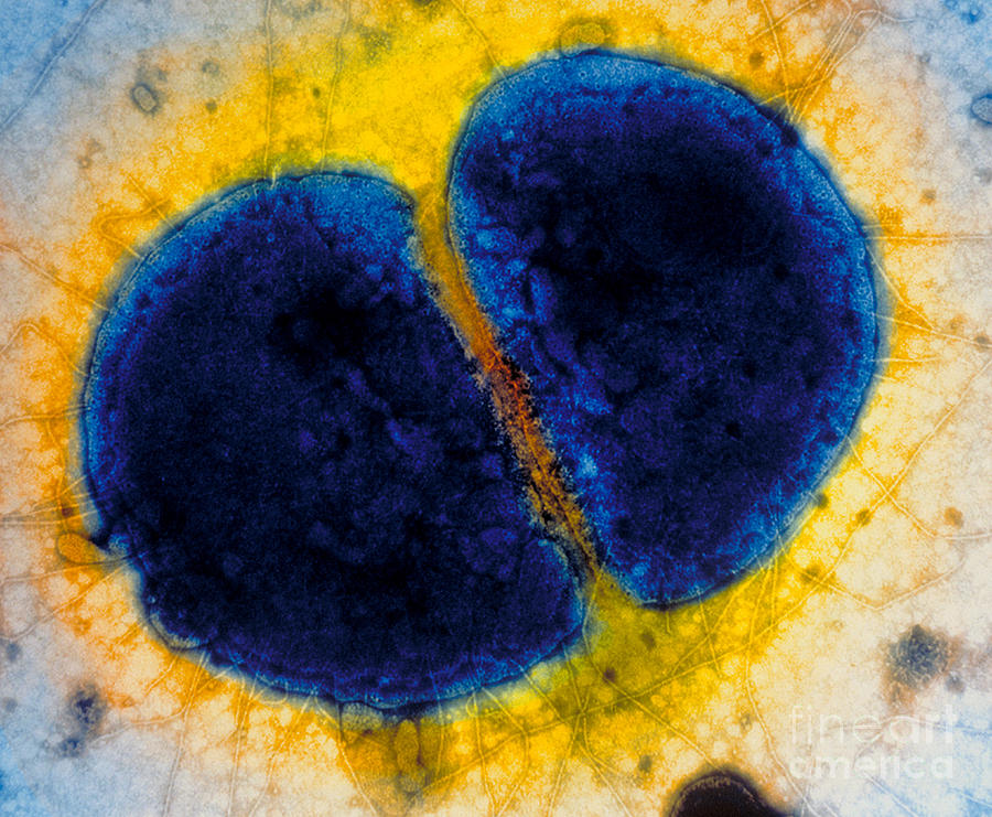 Neisseria Gonorrhoeae #3 Photograph by Kwangshin Kim