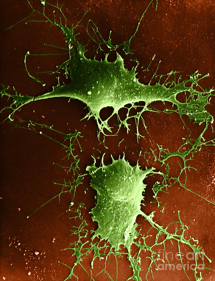 Nerve Cell, Sem #3 Photograph by David M. Phillips