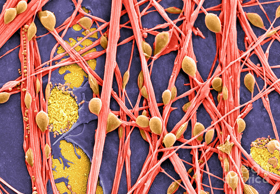 Unique Photograph - Neurons And Glial Cells Sem #3 by Science Source