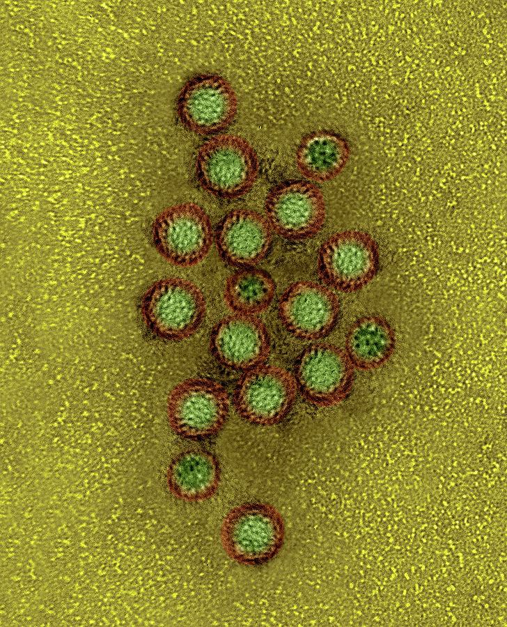 Norovirus Photograph By Dennis Kunkel Microscopyscience Photo Library Pixels