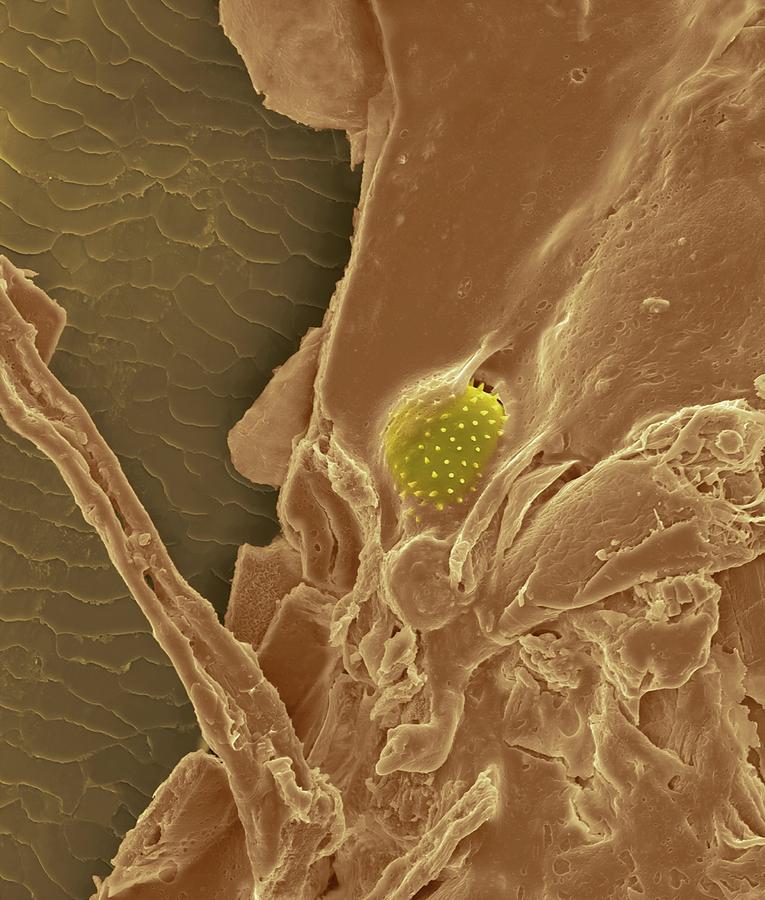 Nose Hair With Mucus And Trapped Pollen Grain #3 Photograph by Dennis Kunkel Microscopy/science Photo Library