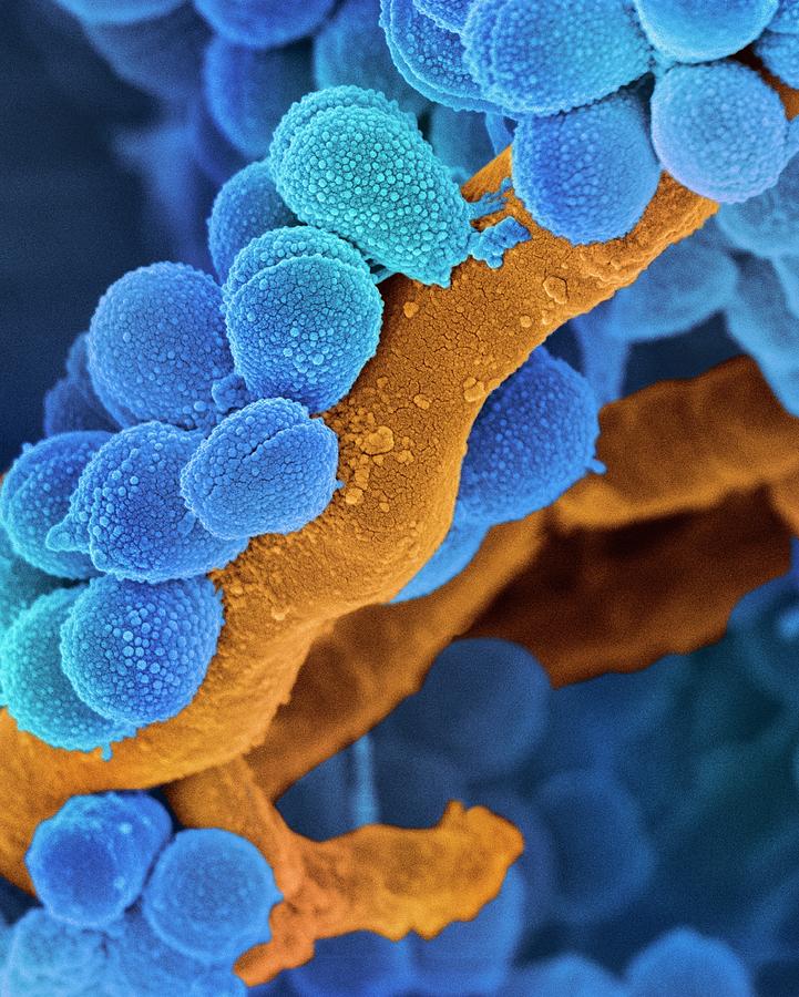Streptococcus Photograph - Oral Streptococcus Bacteria #3 by Science Photo Library