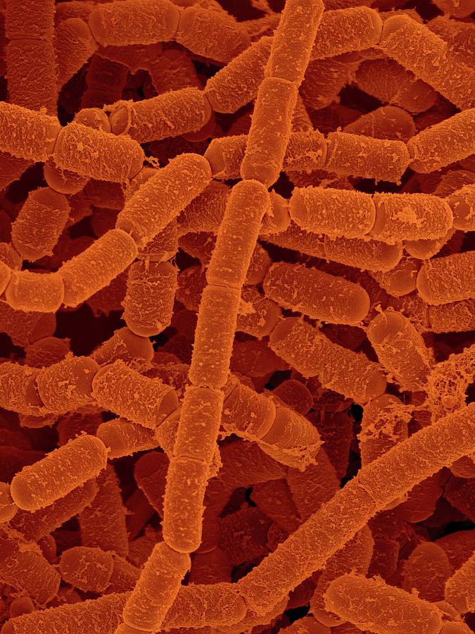 Paenibacillus Amylolyticus #3 Photograph by Dennis Kunkel Microscopy/science Photo Library