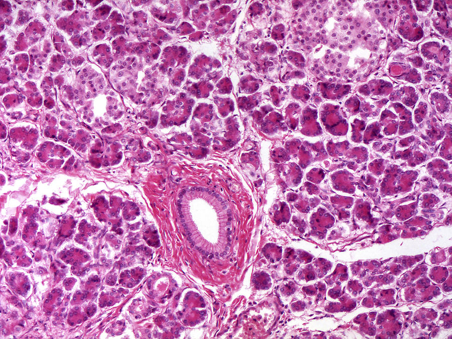Pancreas Lm #2 Photograph by Alvin Telser