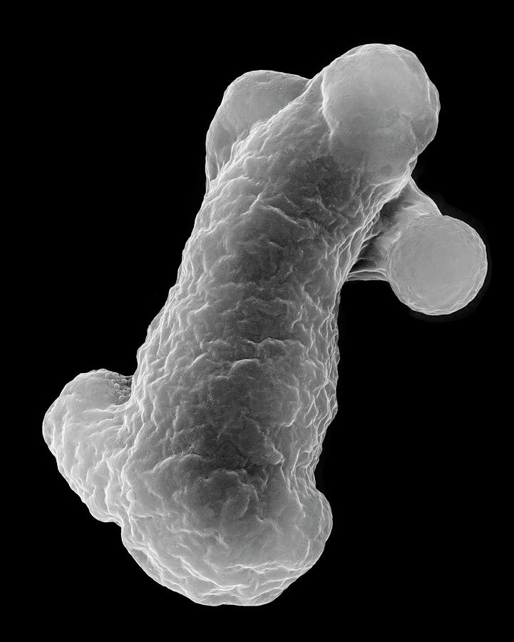 Black And White Photograph - Parasitic Amoeba (entamoeba Histolytica) #3 by Dennis Kunkel Microscopy/science Photo Library