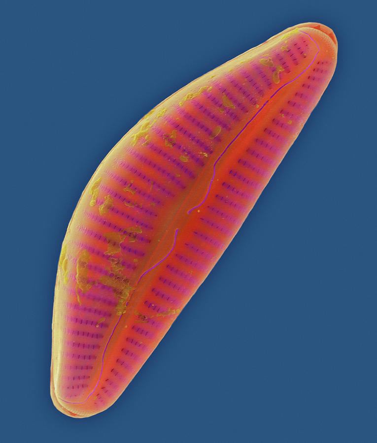 Pennate Marine Diatom (cymbella Sp.) #3 Photograph by Dennis Kunkel Microscopy/science Photo Library