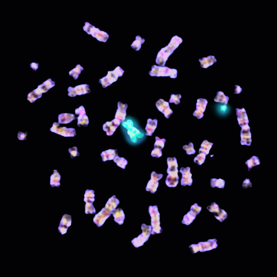 Philadelphia Chromosome #3 Photograph by Dept. Of Clinical Cytogenetics, Addenbrookes Hospital/science Photo Library