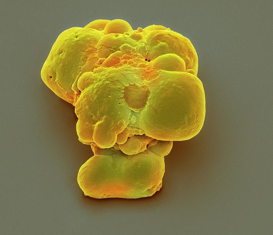 Pluripotent Stem Cells #3 Photograph by Steve Gschmeissner
