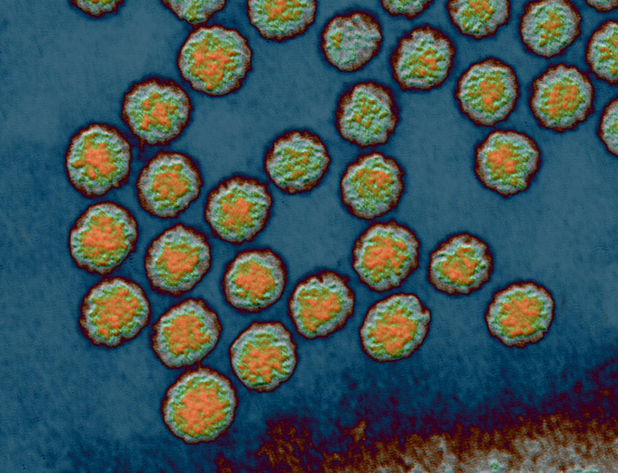 Polio Viruses #3 Photograph by Eye of Science