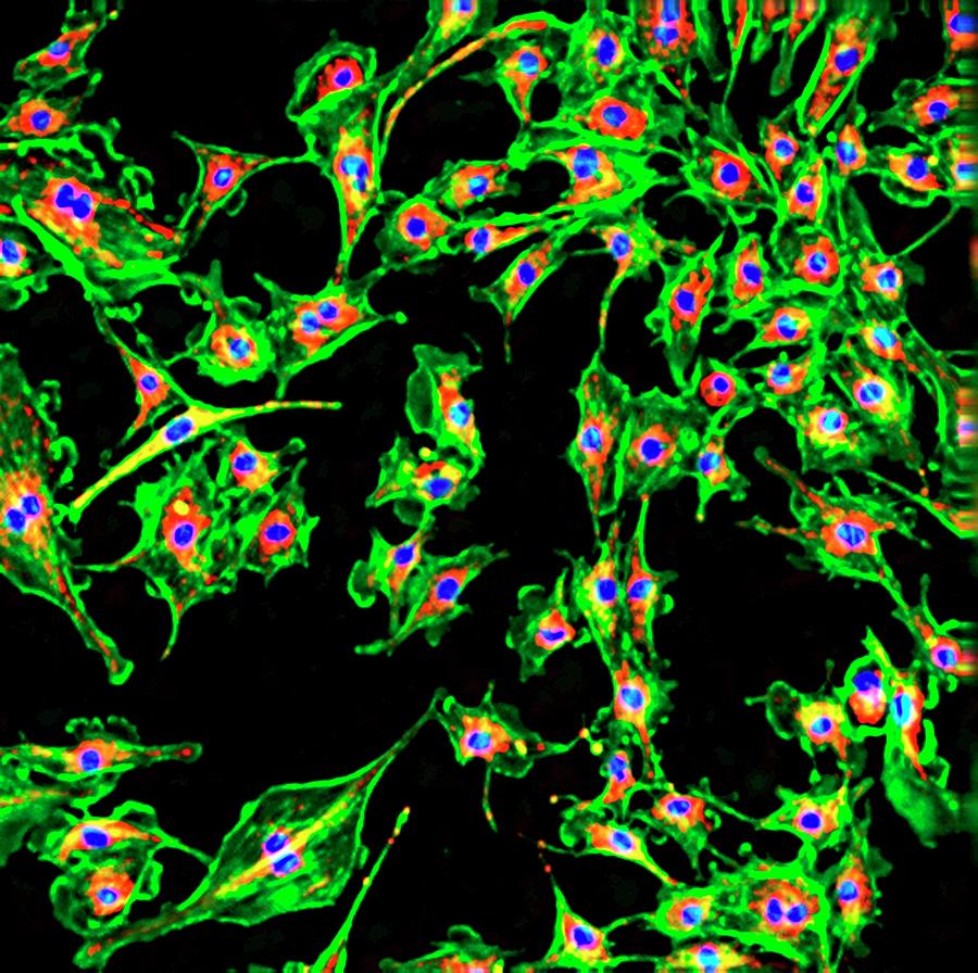 Pulmonary Artery Cells #3 Photograph by R. Bick, B. Poindexter, Ut Medical School/science Photo Library