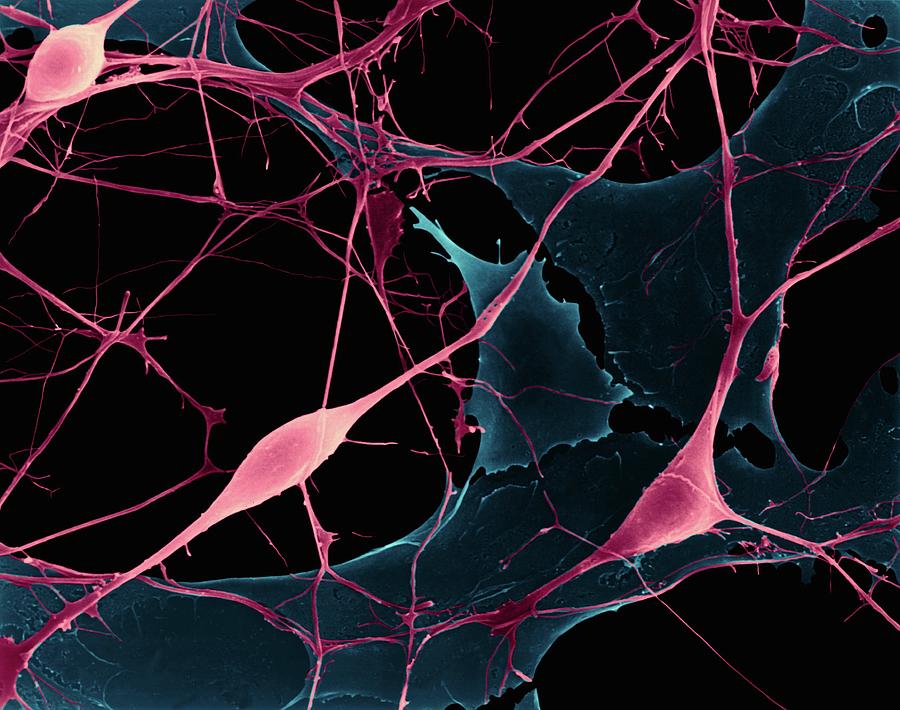 Pyramidal Neurons From Cns #3 Photograph by Dennis Kunkel Microscopy/science Photo Library