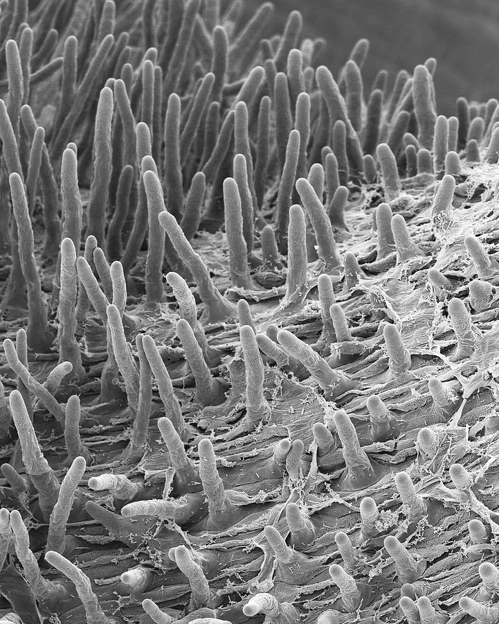 Radish Seed Root Hairs (raphanus Sativus) Photograph by Dennis Kunkel  Microscopy/science Photo Library - Fine Art America
