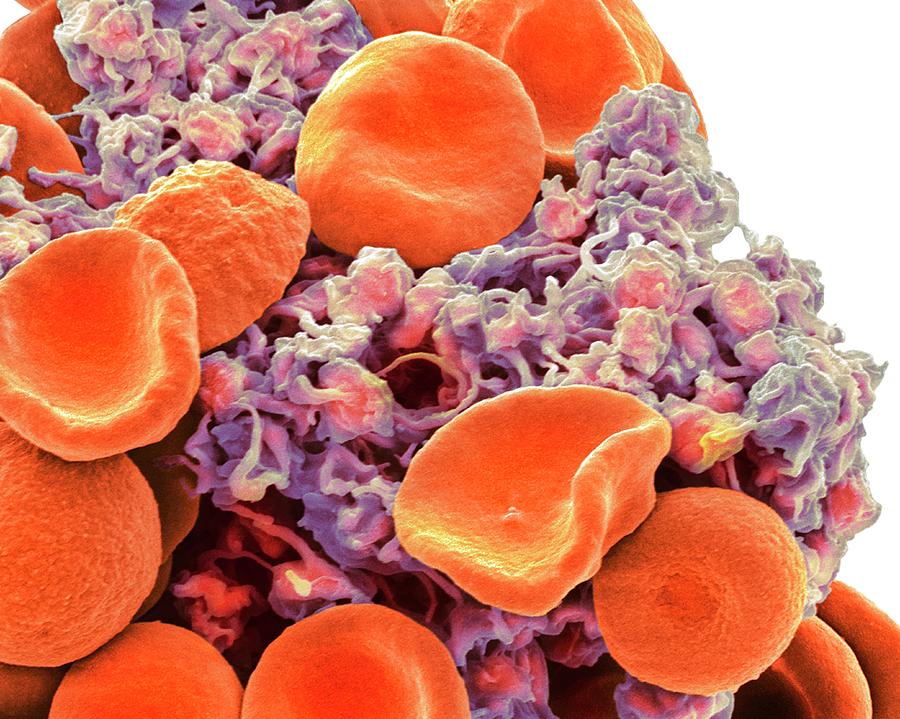 Red Blood Cells And Platelets Photograph by Steve Gschmeissner - Fine ...