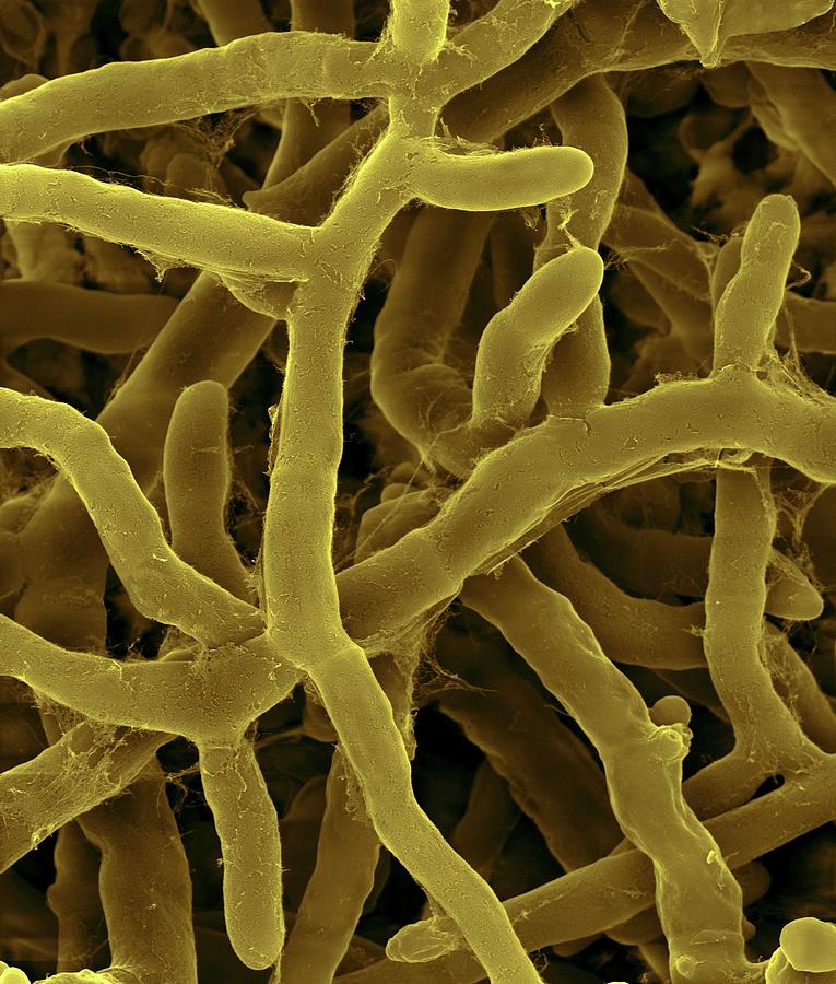Rhizoctonia Solani Pathogenic Plant Fungus #3 Photograph by Dennis Kunkel Microscopy/science Photo Library