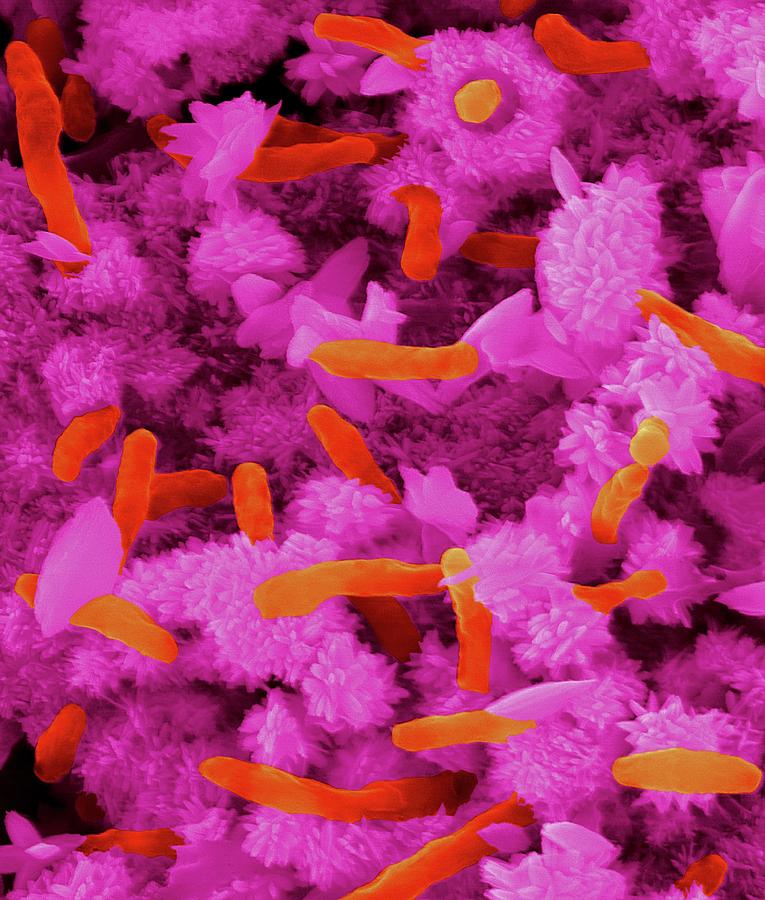 Rhodobacter Ferrooxidans #3 Photograph by Dennis Kunkel Microscopy/science Photo Library
