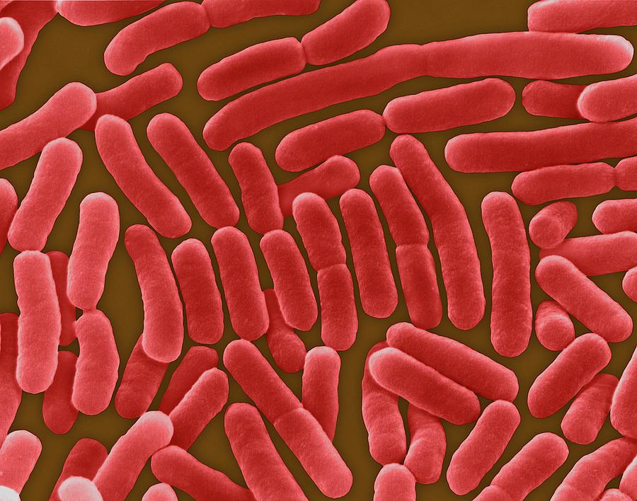 Bacilli Photograph - Salmonella Typhi #3 by Dennis Kunkel Microscopy/science Photo Library