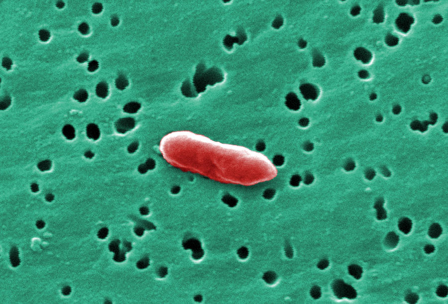 Sebaldella Termitidis Bacteria #3 Photograph by Science Source