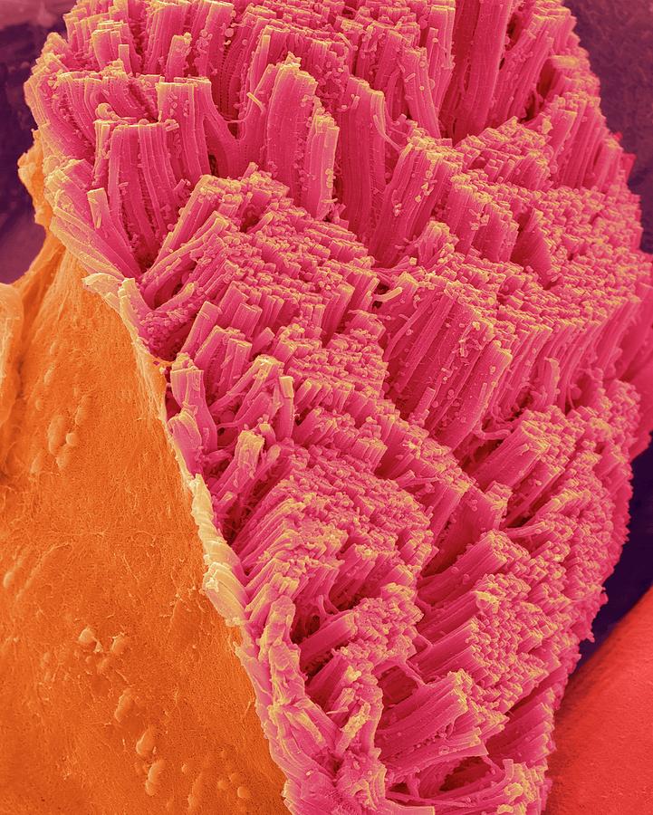 Skeletal Muscle Actin Myosin Filaments #3 Photograph by Dennis Kunkel Microscopy/science Photo Library