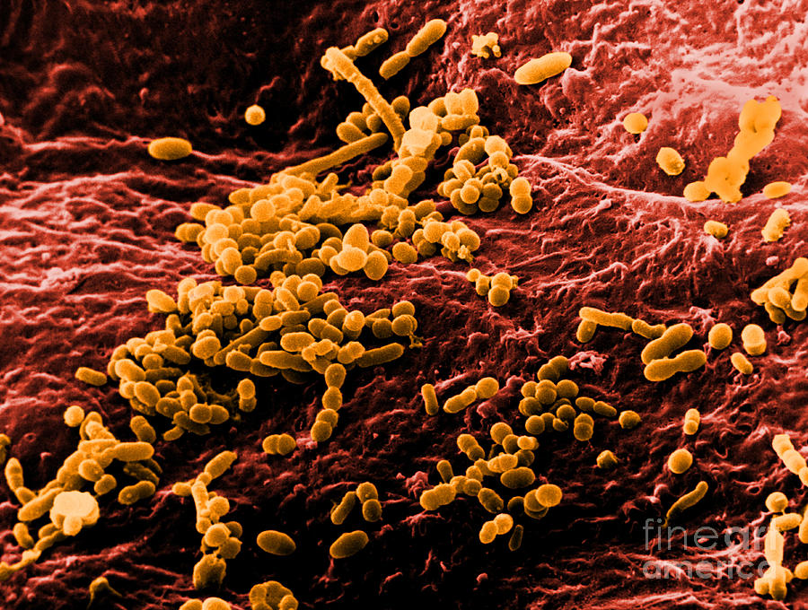 Skin Bacteria, Sem #3 Photograph by David M. Phillips