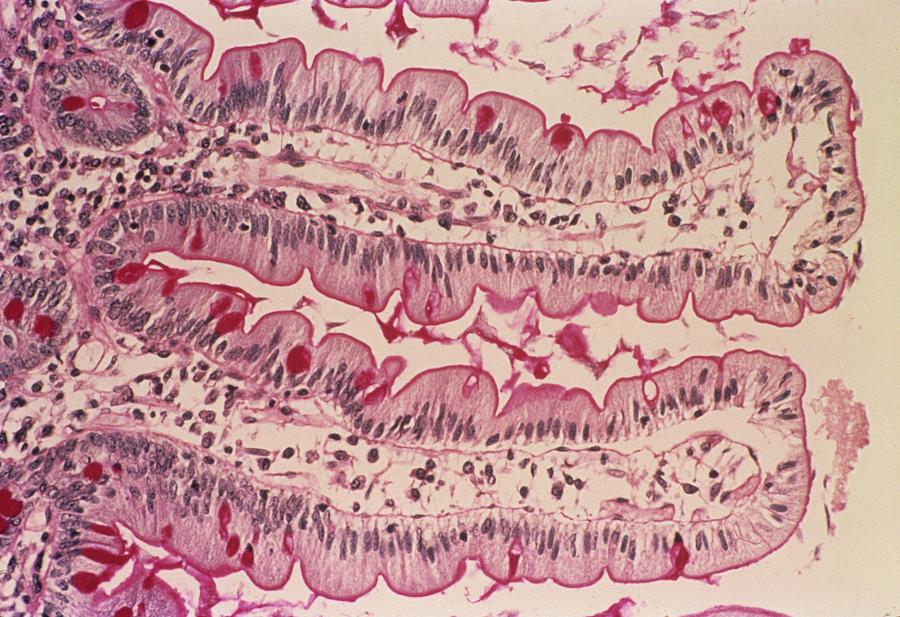 Small Intestine Lining Photograph by Cnri - Fine Art America