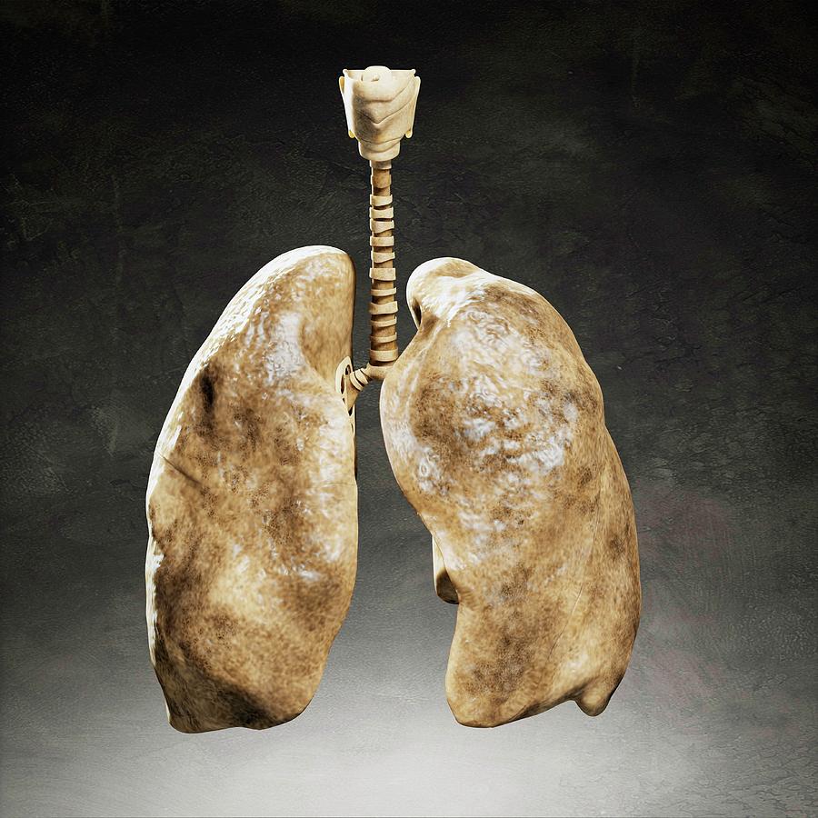 smoker lung sounds