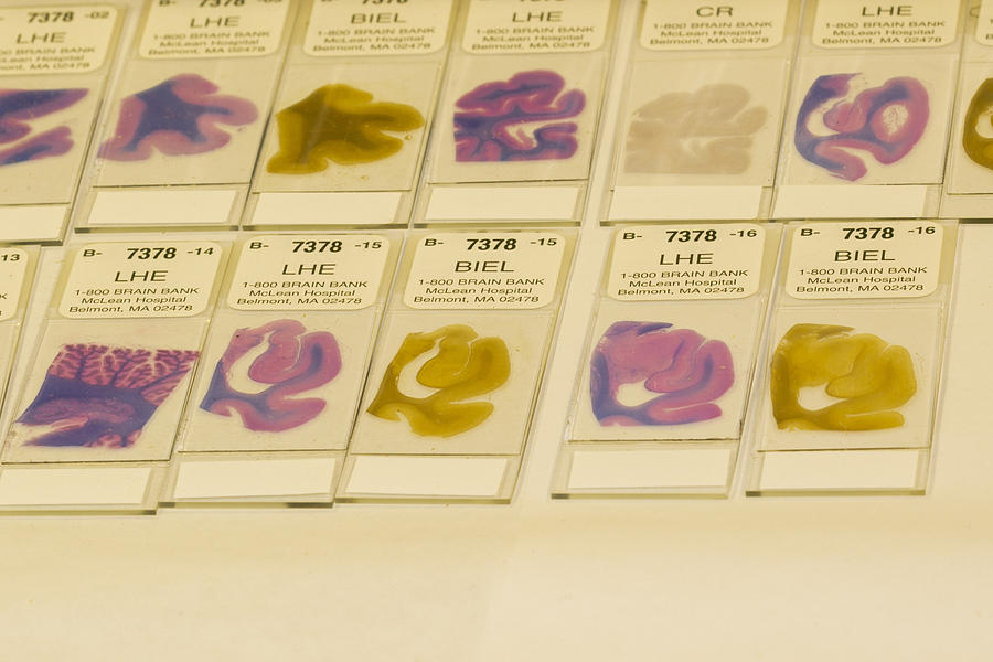 Stained Specimens, Diagnosing Brain #3 Photograph by Science Stock Photography