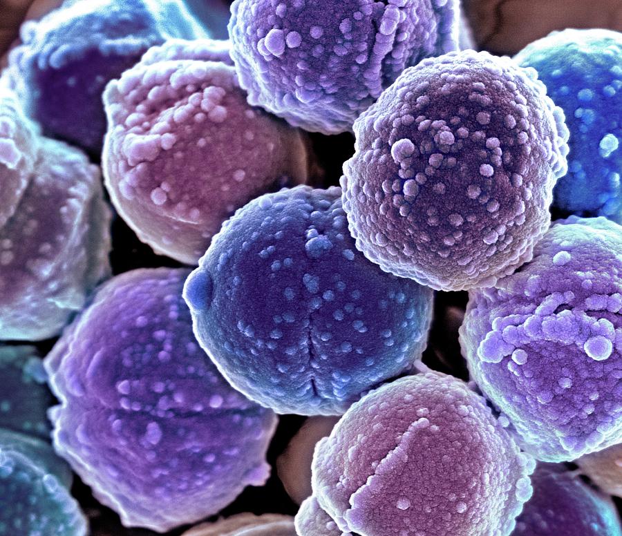 Bakteri Staphylococcus - Perumperindo.co.id