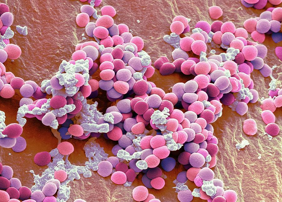 Staphylococcus Bacteria 3 Photograph By Steve Gschmeissner Science