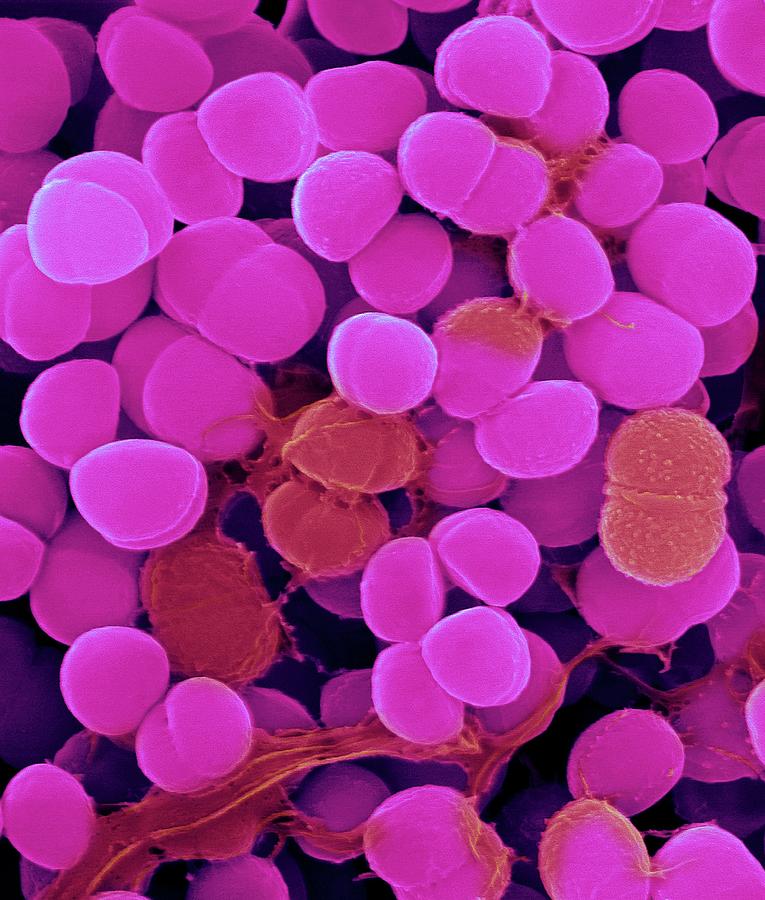 Staphylococcus Haemolyticus Photograph by Dennis Kunkel Microscopy ...