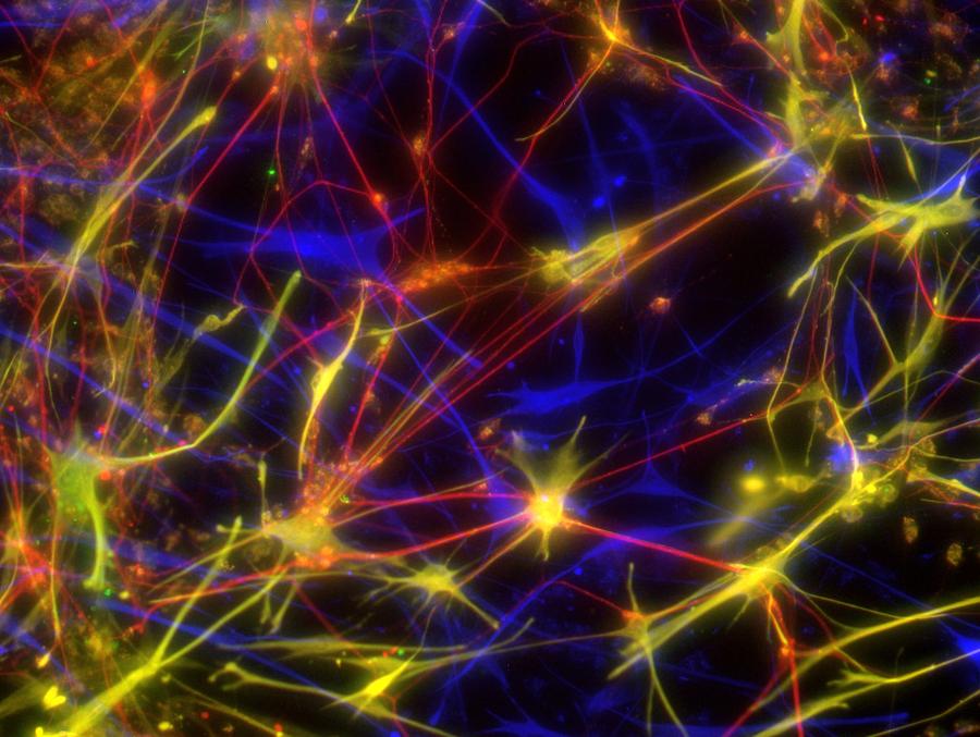 Stem cell-derived nerve cells Photograph by Science Photo Library