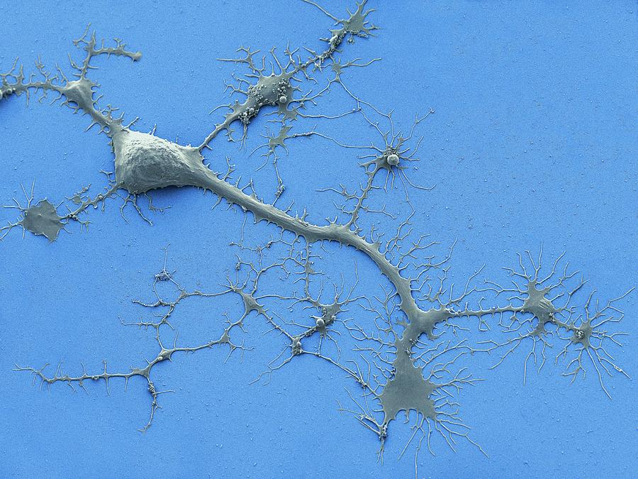 Stem Cell-derived Neuron #3 Photograph by Thomas Deerinck, Ncmir/science Photo Library