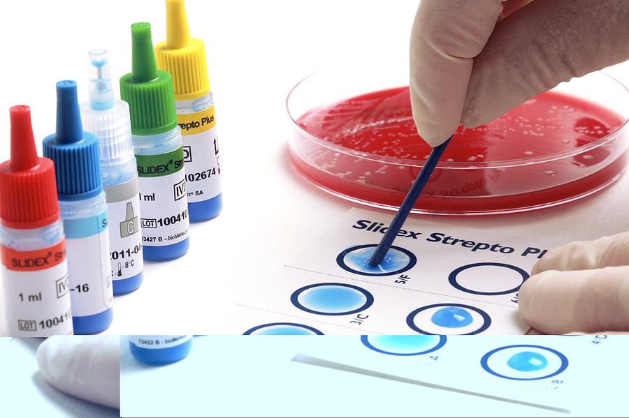 Streptococcus Grouping Test Photograph By Science Photo Library