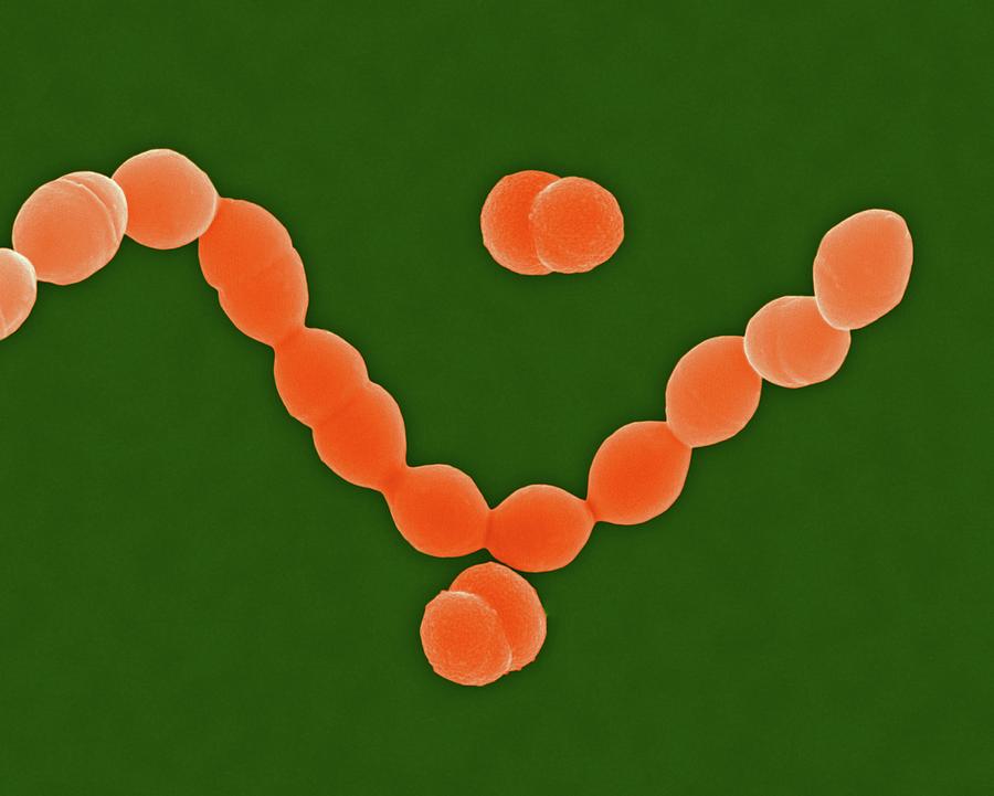 Streptococcus Pneumoniae Coccus Prokaryote Photograph By Dennis Kunkel Microscopyscience Photo 