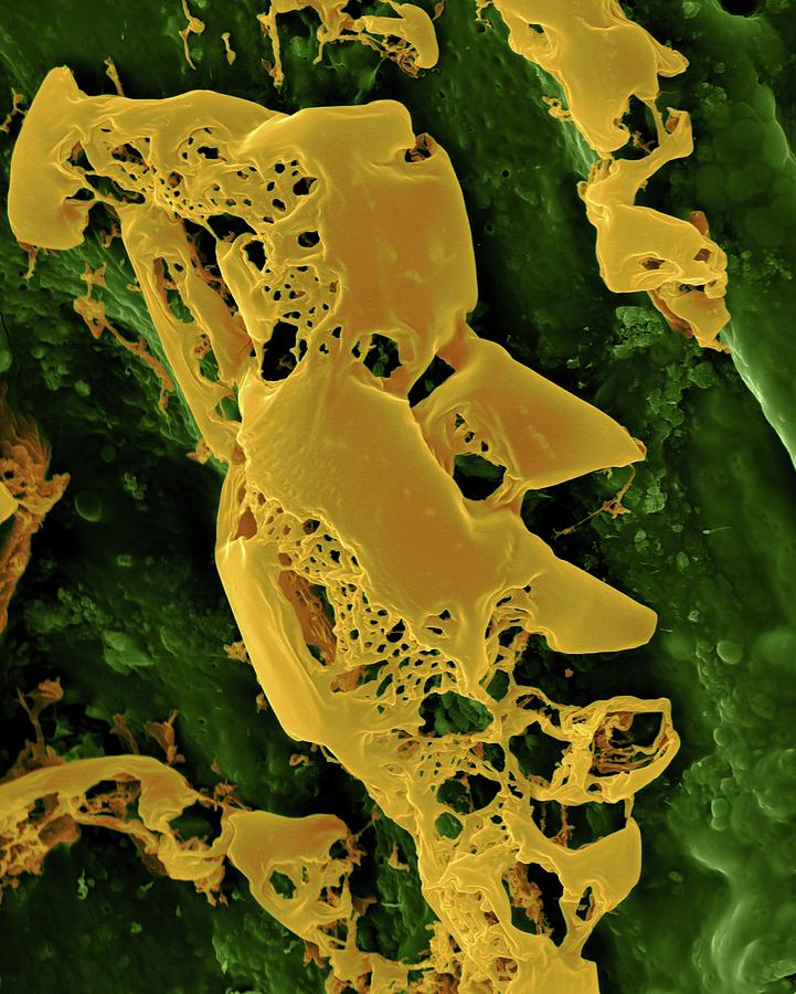 Sulphur Photograph - Sulphur From A Volcanic Steam Vent by Dennis Kunkel Microscopy/science Photo Library Sulphur Photograph - Sulphur From A Volcanic Steam Vent by Dennis Kunkel Microscopy/science Photo Library
