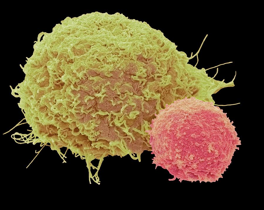 T Lymphocyte And Cancer Cell #3 Photograph by Steve Gschmeissner