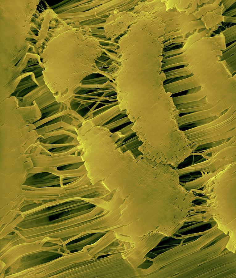 Teflon Tape (plumber's Tape) Photograph by Dennis Kunkel Microscopy ...