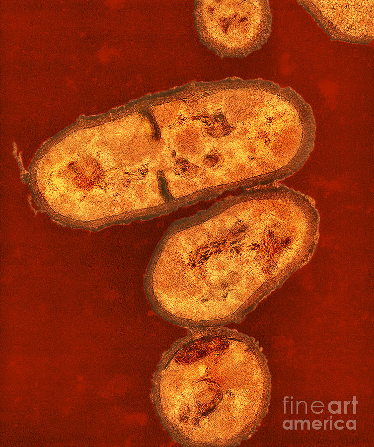 Tem Propionibacterium Acnes #3 Photograph by Kwangshin Kim
