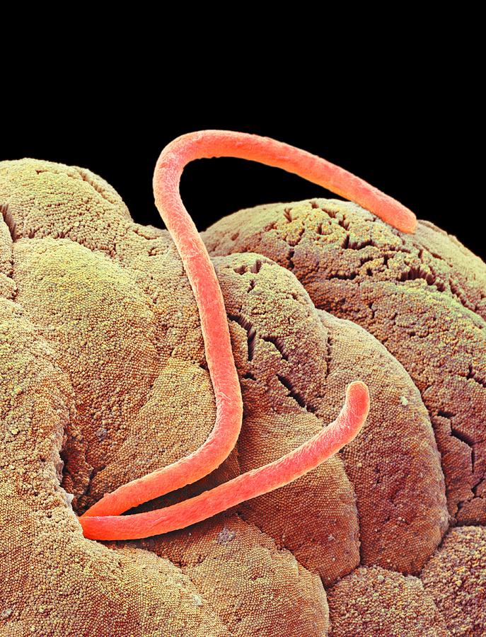 Threadworms In The Gut Sem Photograph By Science Photo Library 6070