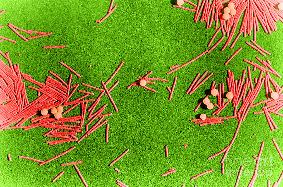 Tobacco Mosaic Virus Tem #3 Photograph by Biology Pics
